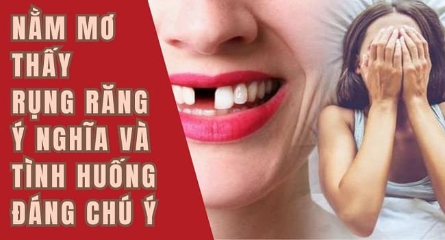 mo thay rung rang